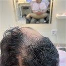 제이에스헤드스파 - 홍성군 청사로150번길 10 | 지친 일상 속 내 두피와 힐링, 송도탈모관리 고민은 제이에스헤드스파에서 확실하게!