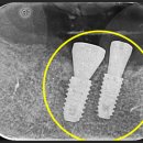 동탄가온치과의원 이미지