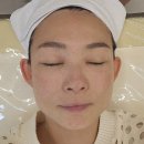 보건메디칼 | [대구달서구 스킨플래닝 아임쏘뷰티]스킨플래닝으로 맑고 밝은 피부톤 만들기