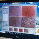 덕영빌딩 | [대구 동성로 모공관리] B10에스테틱 피지 모공 케어 후기