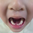 더섬세한치과의원 | 천안 백석동 치과 추천 : 더섬세한치과의원, 스케일링, 유치발치, 상어이(샤크티스)