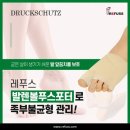 레푸스 경대점 이미지