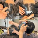 모락스칼프 | 20대 남자 안산탈모 초기 관리 후기! 닥터모락 안산두피 고잔점 재방문의사 있음