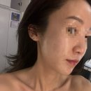 샤이닝에스테틱 | 군자역피부관리 오우시아 샤이닝리프팅 후기｜땅콩형얼굴 윤곽 리프팅 웨딩관리 추천
