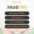 반듯한 이(e)치과교정과치과의원 | 광주교정치과추천 어금니 가위교합? 치아교정