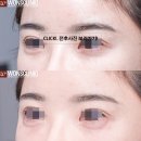 명품피부과의원 네이버블로그