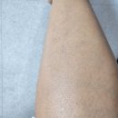 전동물병원 | 면도기 대신 모근제거기 소네진 전동 트리머 사용후기