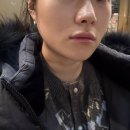 신사동-23 | 강남 온다리프팅 후기 신사역 리프팅 잘하는 곳