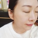 이혜주 뷰티샵 | 노원 아이라인 반영구제거 2회차 이혜주뷰티샵 내돈내산