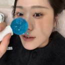 (주)한코교역 | 부산피부과추천 복코 해결 코조각주사 후기, 통증 후기