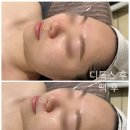 (주)드림노트엔터테인먼트 | 종암동 근처 피부샵 올가드림뷰티 종암점 가족 결혼식 전 민감해진 피부에 PDRN물광재생관리 후기