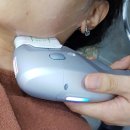 천안 불당동피부과 톡스앤필의원 천안불당점 슈링크 리프팅 리얼 후기! 슈링크 리프팅 효과!