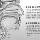 두경부암으로 의심되는 12가지 증상과 예방 수칙 이미지