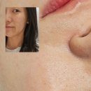 백설공주 | 면목동 피부관리 바나나부띠끄 재방문 백설공주케어 후기