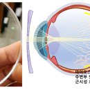 모먼트아이안경원 이미지