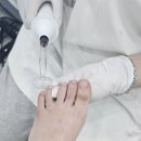 [부산 남구] *독일식 문제성 발 관리 전문점* 레푸스 부산 대연점 후기