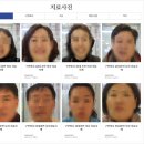 안면근육마비, 한의원이 알려드리는 병원 선택 기준 2가지