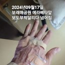 2024~09~17 .18일 양쪽손등 온쪽무릎 입술위인중 왼쪽가슴통증 상처 이미지