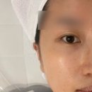 메디스킨 | 잠실 피부관리 잘하는곳 데자뷰메디스킨 광광케어 솔직후기