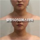 셀럽5050에스테틱 | 구미옥계웨딩관리 상체관리로 날렵해진 얼굴 셀럽5050에스테틱