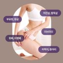 이게진짜찐 대전둔산점 | 림프순환이 살을 뺀다?🌿 대전다이어트 둔산점에서 찾은 건강 다이어트 비밀 대공개!🤫