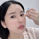 1회 100만원 5만원으로 셀프 슈퍼젝션 홈키트 내돈내산 홈케어 후기