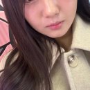 진 | 위례피부과 텐트리플 리프팅으로 날렵해진 후기