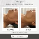 피부숨소리