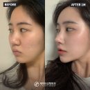 제이티성형외과의원 이미지