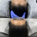 두핏 네이버블로그