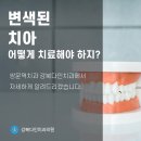 치아가 변색되어 고민되신다면, 쌍문역치과 강북다인치과에서 치아미백 받으세요 이미지