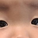 바른눈서울안과의원 이미지