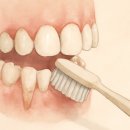 정찬권에이블치과의원 | 동대문구치과 선택 전 치아시림 원인과 관리 루틴 정리