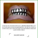 치아살리기 드림365치과의원 이미지