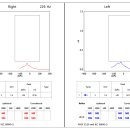 보청기클리닉 이미지