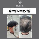 모앤미가발 | 가성비 갑! 자연스러운 광주남자부분가발 후기 (모앤미 광주점 방문기)