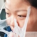 젤라 이미지