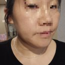 한창기계 | 홀드랩 써마3 리프팅 기기 찐 내돈내산 솔직 후기