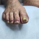 성모메디칼약국 | 수원 발톱 무좀병원 고민해결 후기