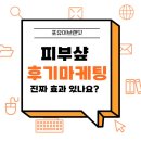 SNS홍보전략 | 피부관리샵 SNS홍보 후기만으로 예약률 높이는 법
