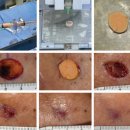 (주)로킷헬스케어 이미지