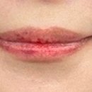 누브의원 이미지