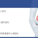 더참본정형외과 이미지