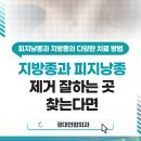 경대연합외과의원 | 경대연합외과 지방종, 피지낭종 제거 잘하는 곳 찾는다면