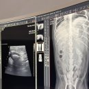 (주)더원메디칼 네이버블로그