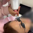 (주)우원 | 분당 미금역 눈썹맛집 브로우원에서 엄마 눈썹 문신 안전하게 예쁘게 제거한 후기