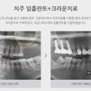 고운미소치과의원 이미지