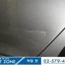 덴트존 이미지