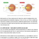 대구백내장안과 젊다고 안심은 금물! 대구안과 검진 후기