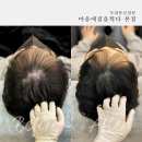 김정화헤어라인 티스토리